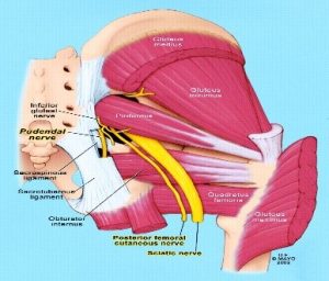 buttock pain