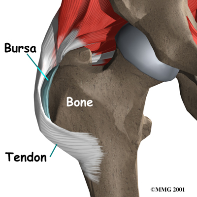 Gluteal Tendinopathy Symptoms